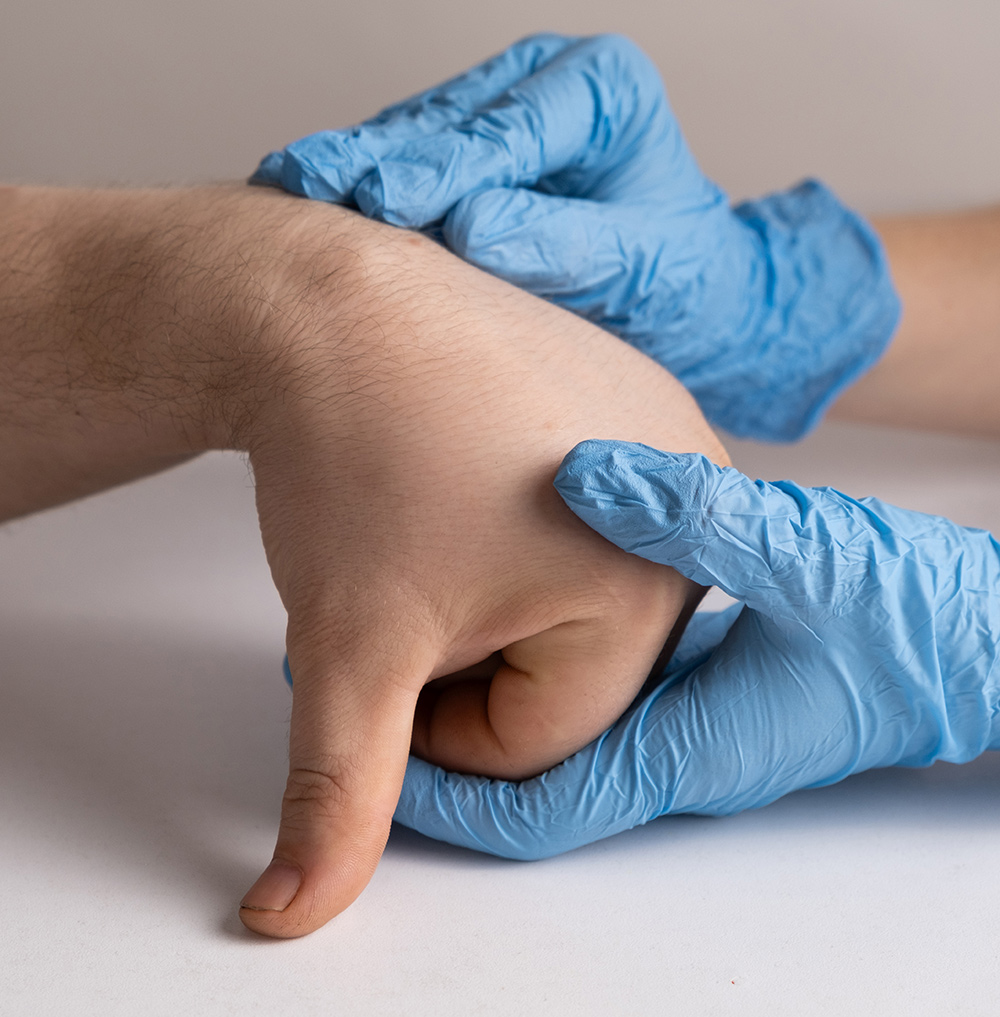 ganglion cyst wrist, ganglion cyst wrist treatment, wrist nerve compression